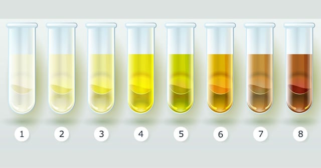 ¿Qué dice el color de tu orina sobre la salud?