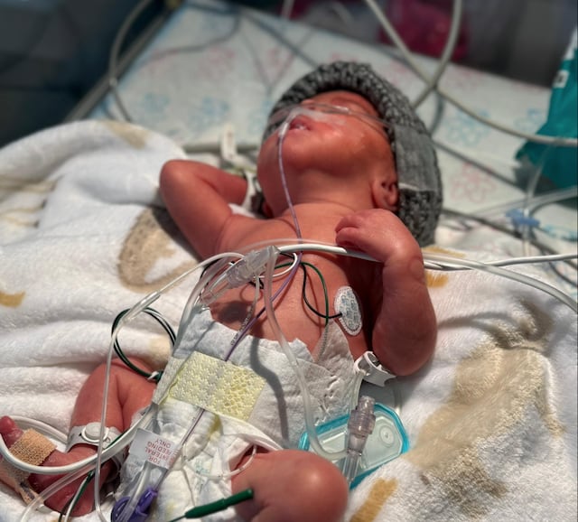 Familia de Moca pide ayuda para bebé prematuro hospitalizado desde hace dos meses