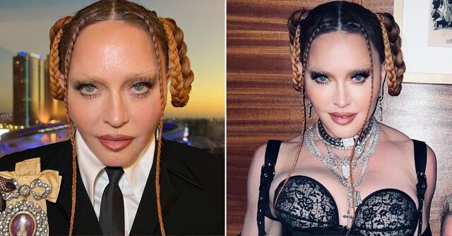 Así ha cambiado el rostro de Madonna a través del tiempo