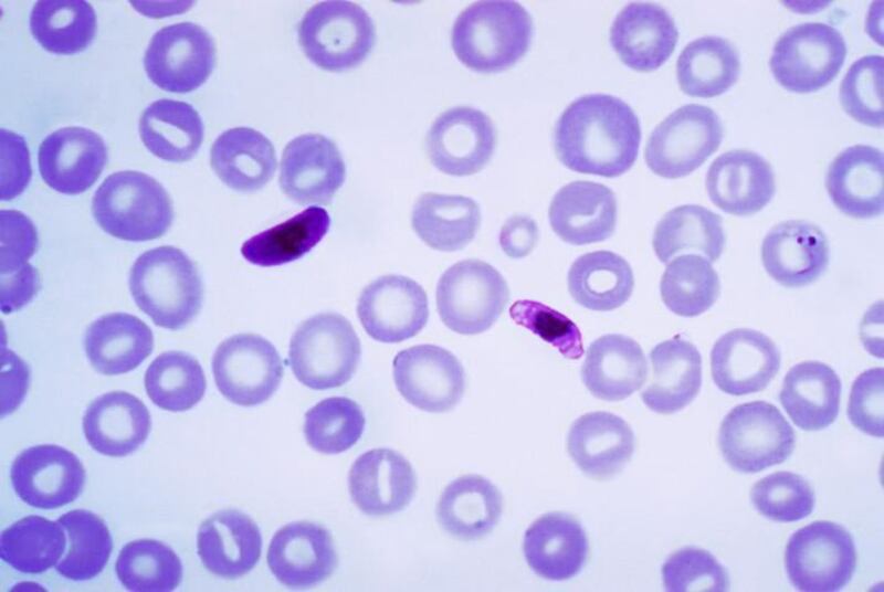 Plasmodium falciparum, un parásito que causa la malaria en seres humanos