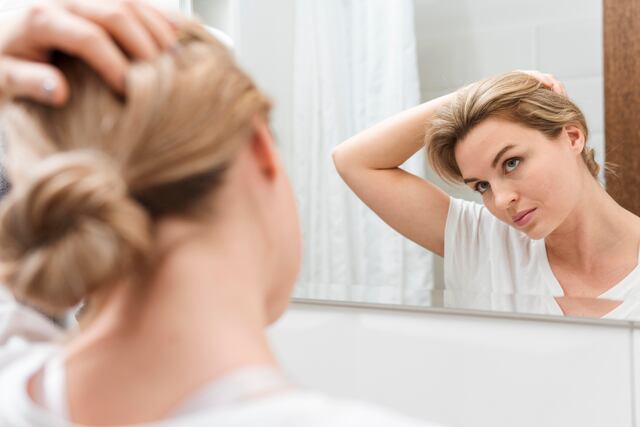 Cada vez más mujeres buscan ayuda por caída de cabello