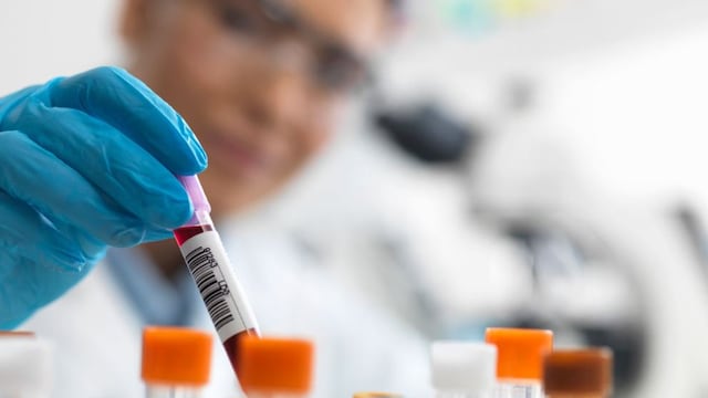 Análisis de sangre podría predecir el Parkinson siete años antes de cualquier síntoma