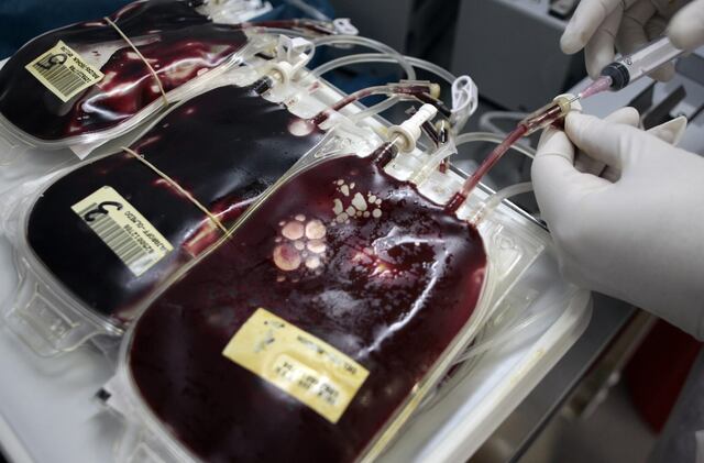 Estos grupos sanguíneos tienen más riesgo de sufrir un ataque al corazón