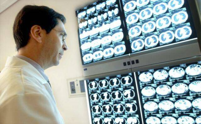 ¿Cómo identificar si tengo cáncer de colon?