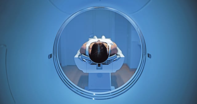 Pacientes con VIH enfrentan deterioro cognitivo a edades más tempranas que población general