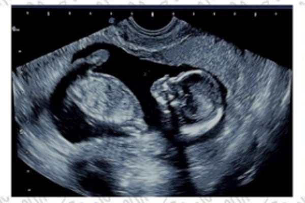 Reportera de “Telenoticias” anuncia su embarazo