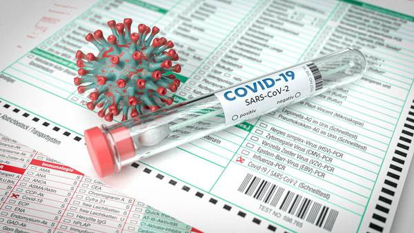 Salud reporta 392 personas hospitalizadas por COVID-19