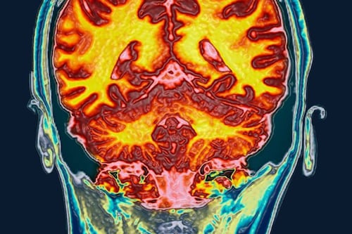 Científicos confirman cambios en regiones del cerebro durante el ciclo menstrual