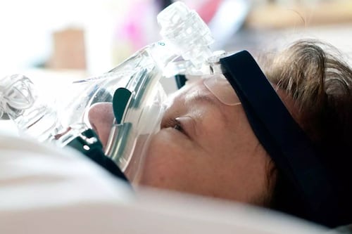 Apuestan a la inteligencia artificial para devolverle la voz a pacientes con esclerosis lateral amiotrófica