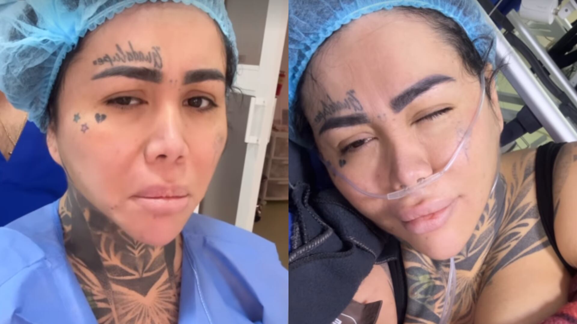 Yina Calderón se operó por biopolímeros