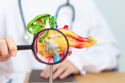 Este cáncer no presenta síntomas hasta etapas avanzadas: lo que debes saber