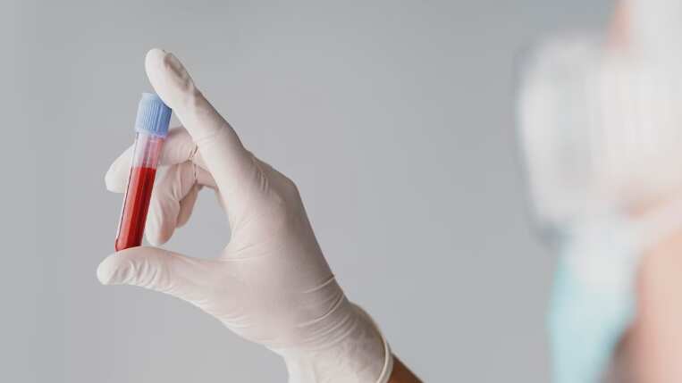 Prueba de sangre para detectar el alzhéimer