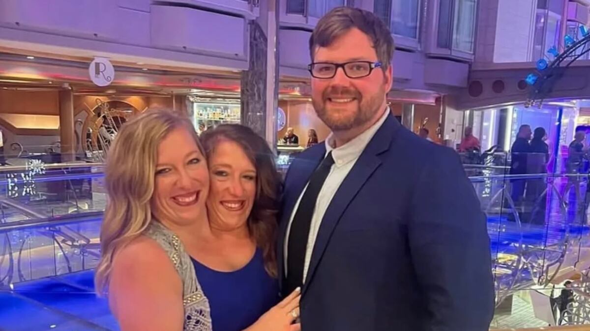 Siamesas Abby y Brittany Hensel