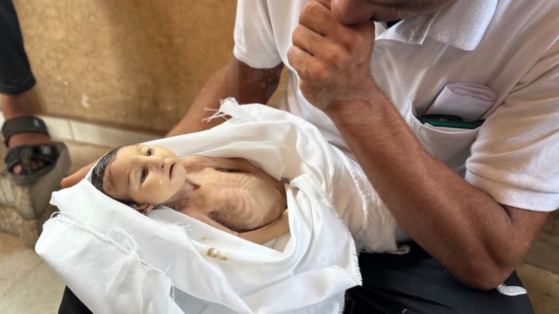 La bebé desnutrida Wafaa Abu Masoud murió de hambre en el Hospital Nasser.