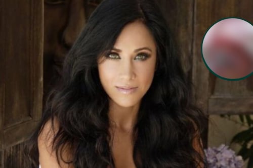 Hermana de Mónica Noguera es atacada por un cocodrilo: “Pensé que me iba a desangrar”