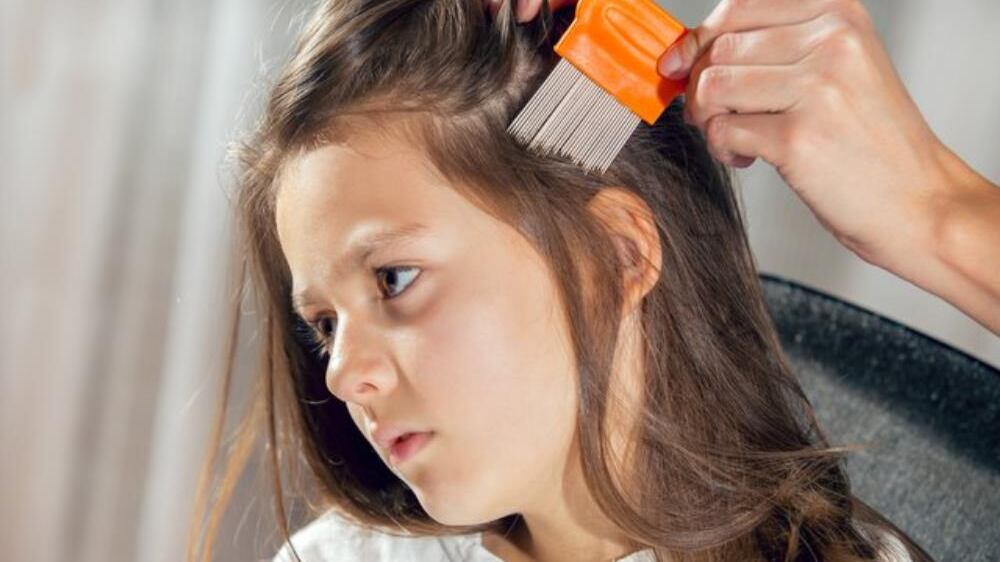 Sacar piojos es el oficio de una emprendedora en Nueva York.