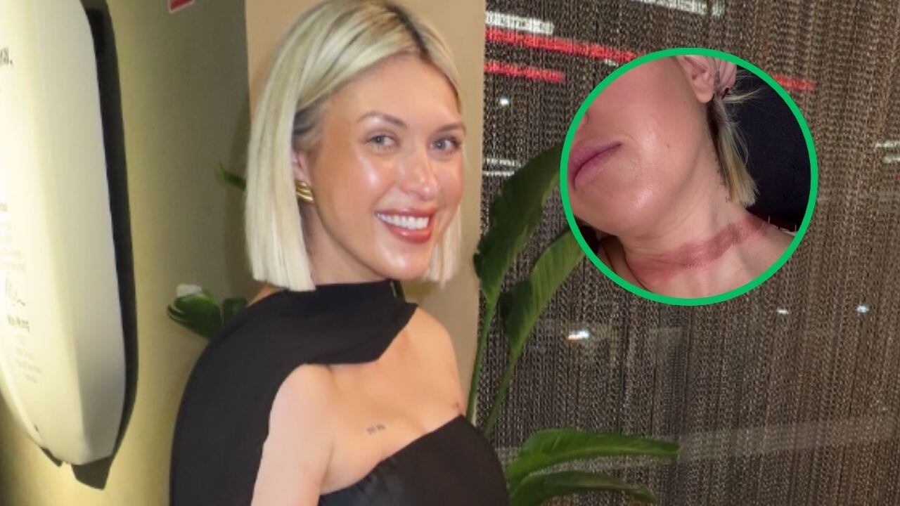 Influencer casi muere por culpa de su bufanda