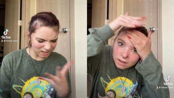 La chica dejó de grabar en Tik Tok cuando empezó a sangrar.