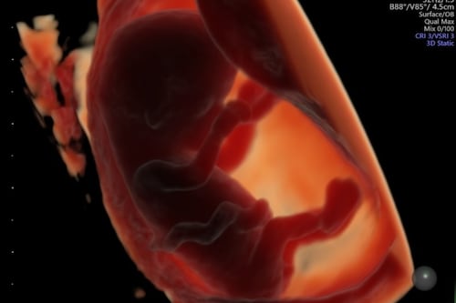 Alimentos ultraprocesados podrían afectar la fertilidad y el desarrollo del feto, según estudio