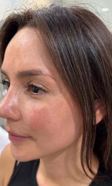 La actriz colombiana está en tratamiento por su afección cutánea |