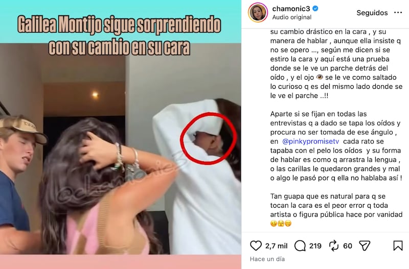 Chamonic muestra "cicatriz" en el rostro de Galilea Montijo