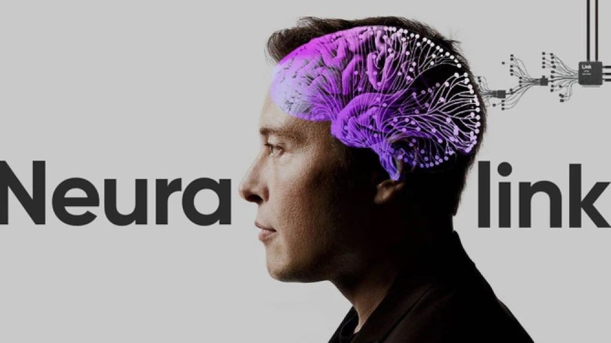 Neuralink, de Elon Musk, espere implantar chips en cerebros humanos a mediados del 2023