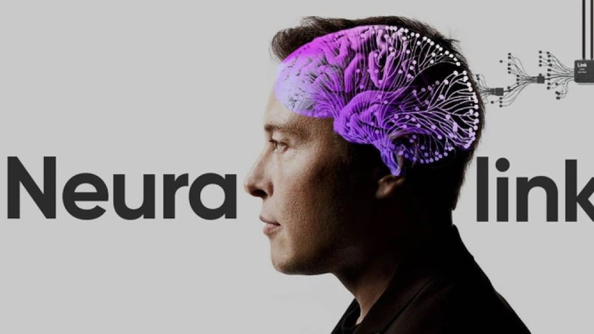 Neuralink, de Elon Musk, espere implantar chips en cerebros humanos a mediados del 2023