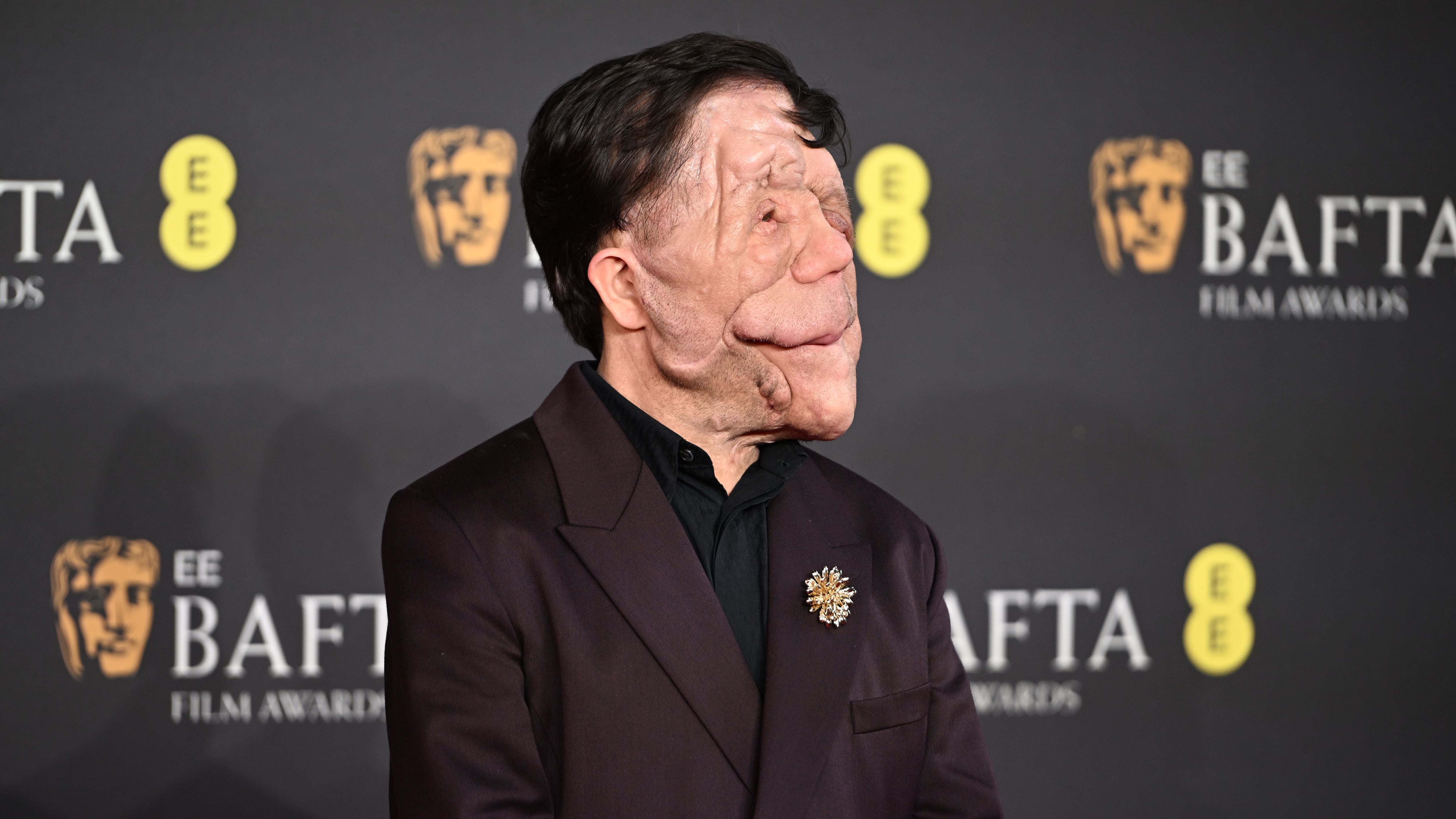 Es un actor, presentador y activista británico que ha inspirado a miles de personas con su historia de vida