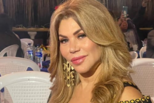 Actriz de ‘Pasión de gavilanes reveló cómo los biopolímeros transformaron su vida: “Le pedí perdón a Dios”