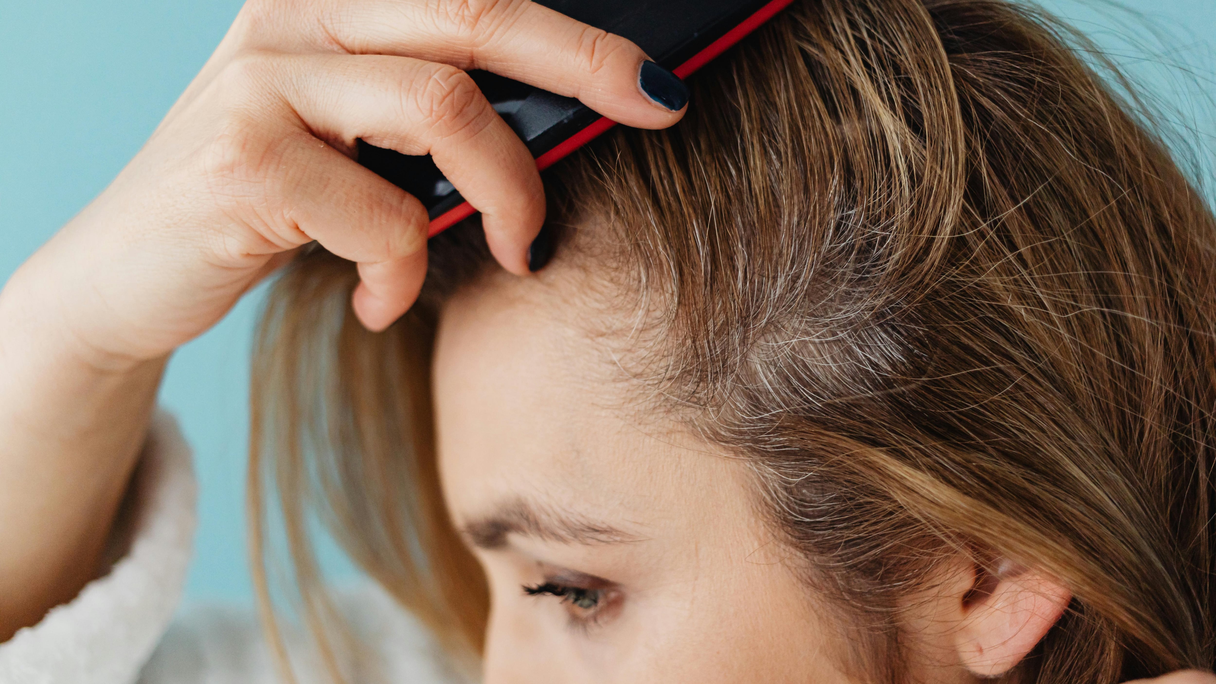 ¿Canas jóvenes? 4 causas que no son genética y cómo evitarlas