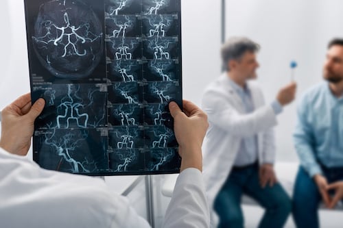 Estiman más de 4,000 casos nuevos de “strokes” anuales en Puerto Rico