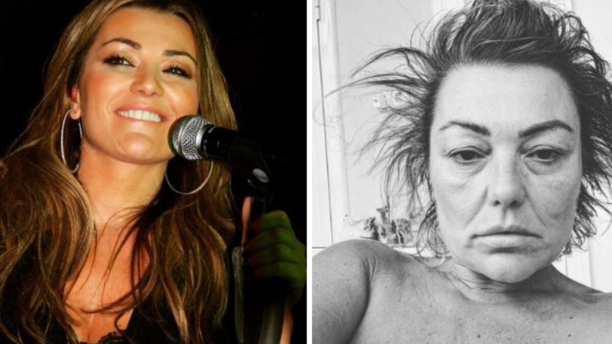 la cantante española y ex integrante del famoso grupo "La Oreja de Van Gogh", Amaia Montero, sigue preocupando a sus seguidores