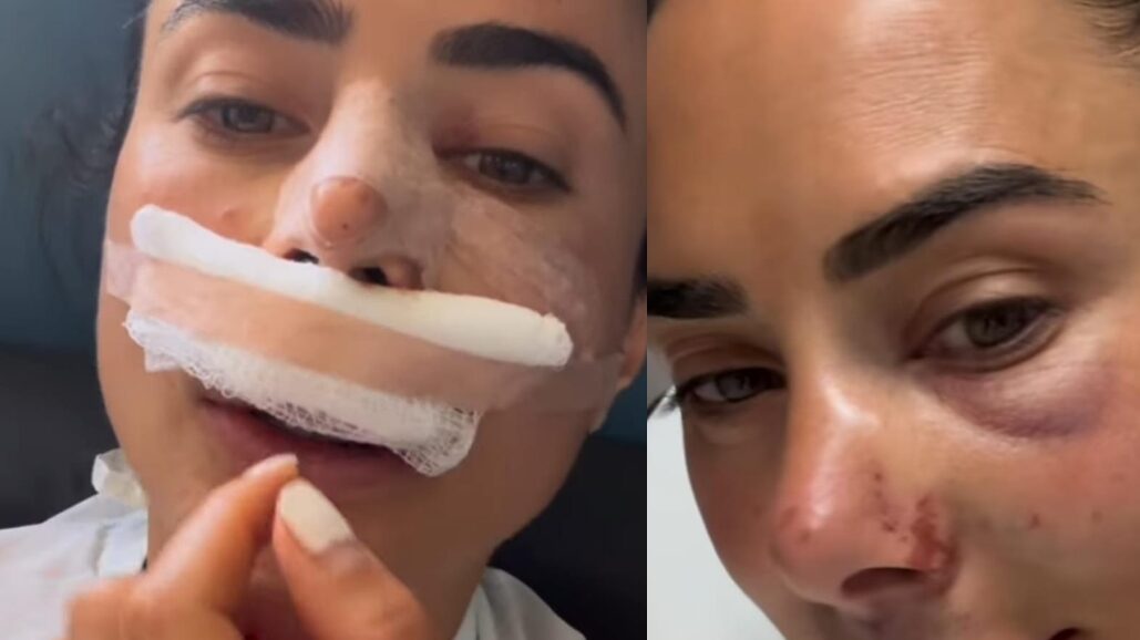 Johanna Fadul tuvo delicado accidente en medio de reality “se me salió un disco de la columna”