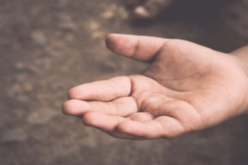 Niño sufre fractura de brazo y trauma craneal tras caída