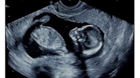 Imagen publicada por la comunicadora en sus redes sociales.