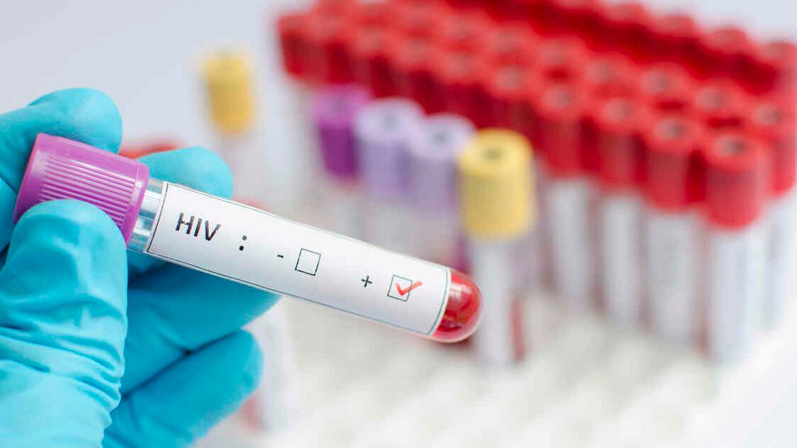 La estadística señala que una de cada siete personas desconoce que es portador del VIH y eso provoca una cadena de contagios que es la que se pretende frenar.