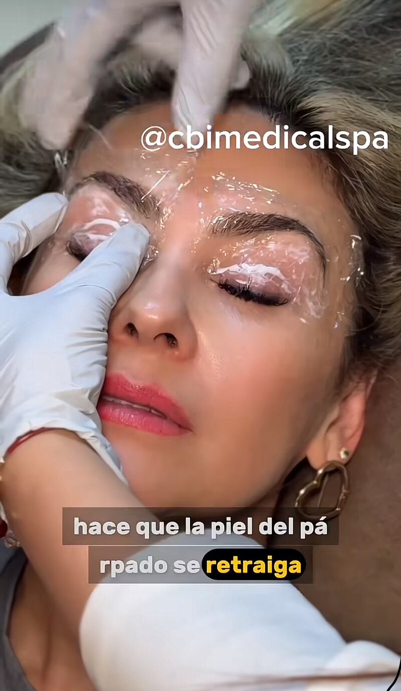 Aracely Arámbula se hizo una blefaroplastia