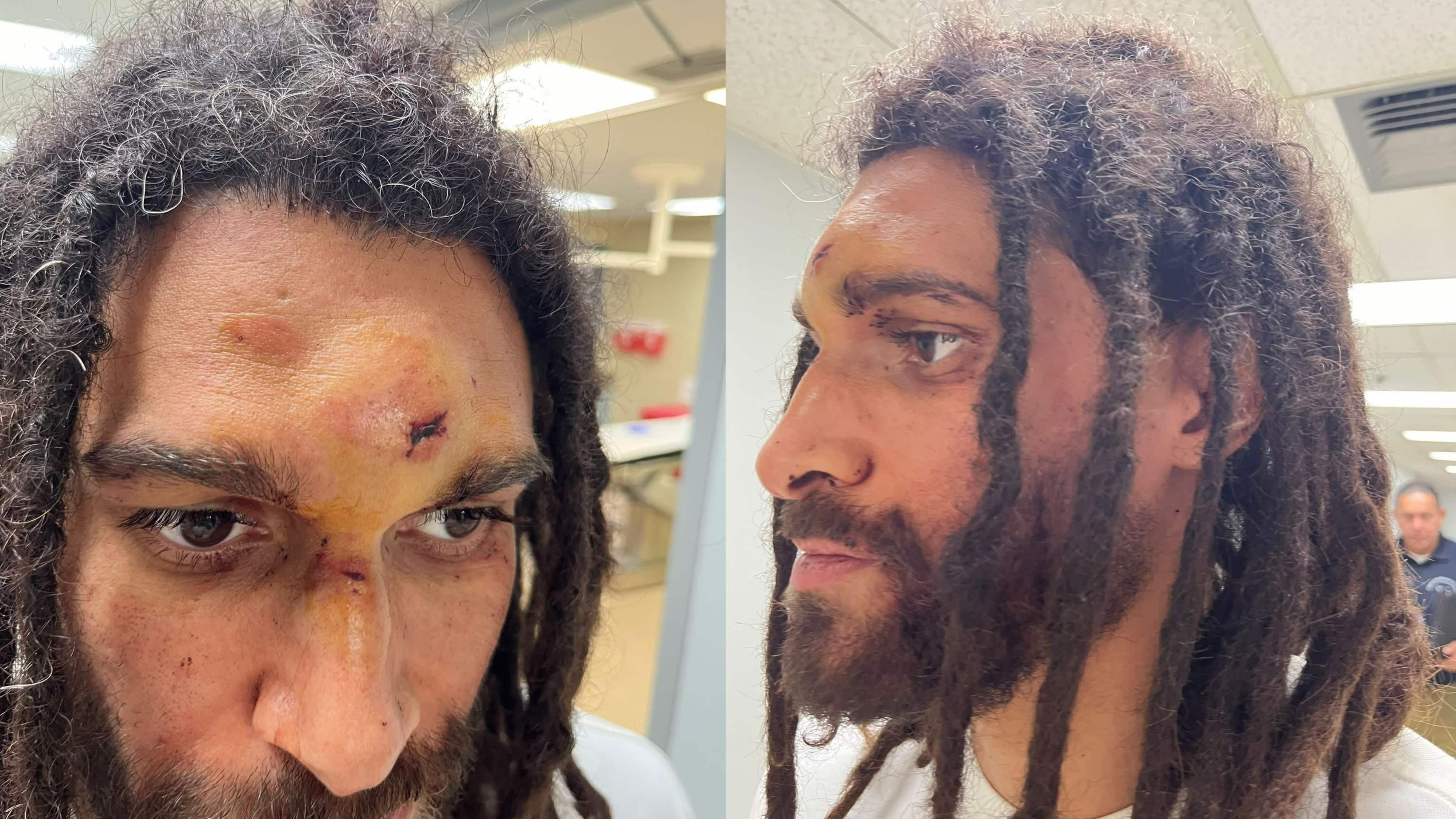 "Prospe" denunció haber sido víctima de abuso policiaco.