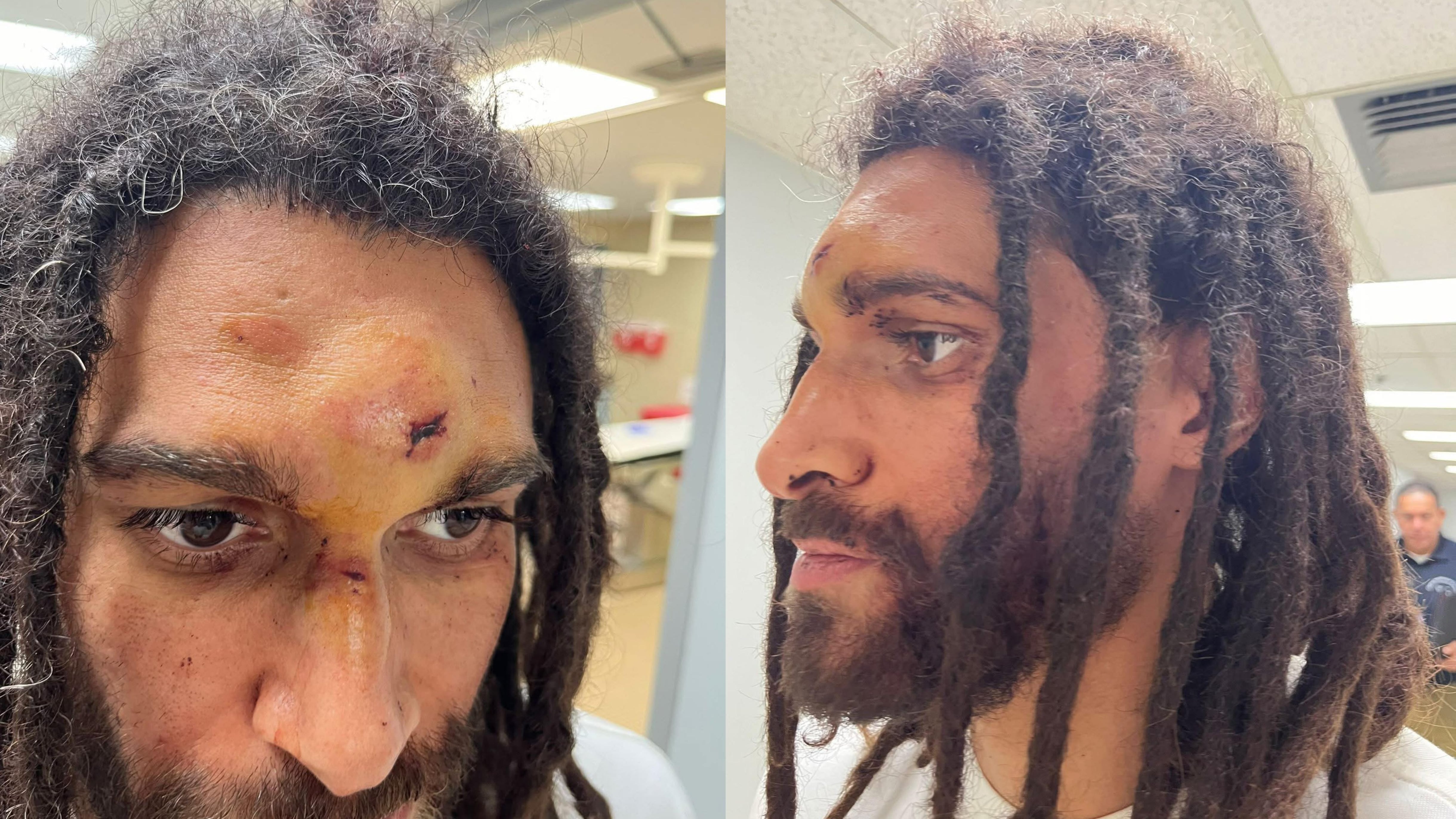 "Prospe" denunció haber sido víctima de abuso policiaco.