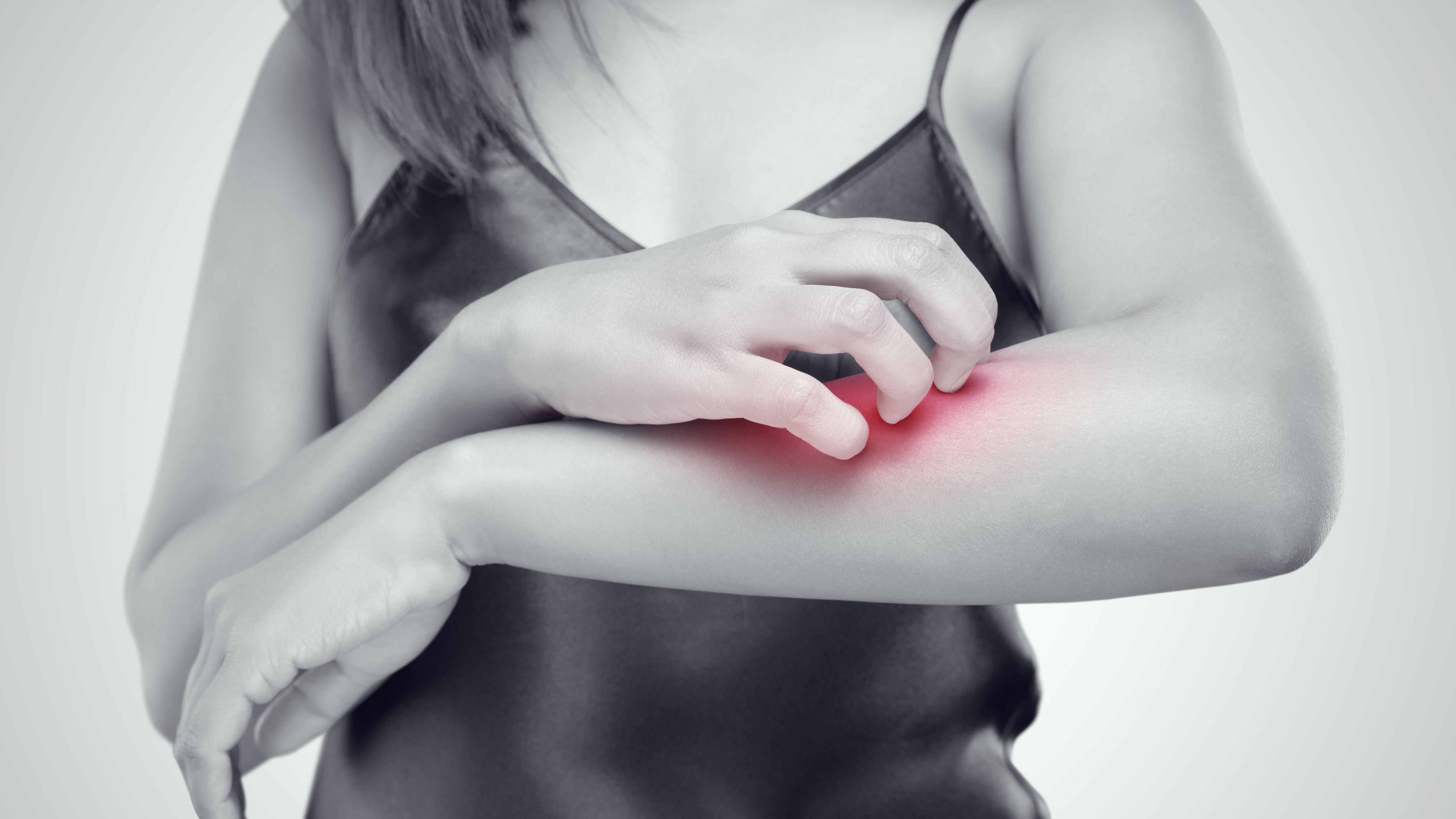 People scratch the itch with hand, Arm, itching, Concept with Healthcare And Medicine.