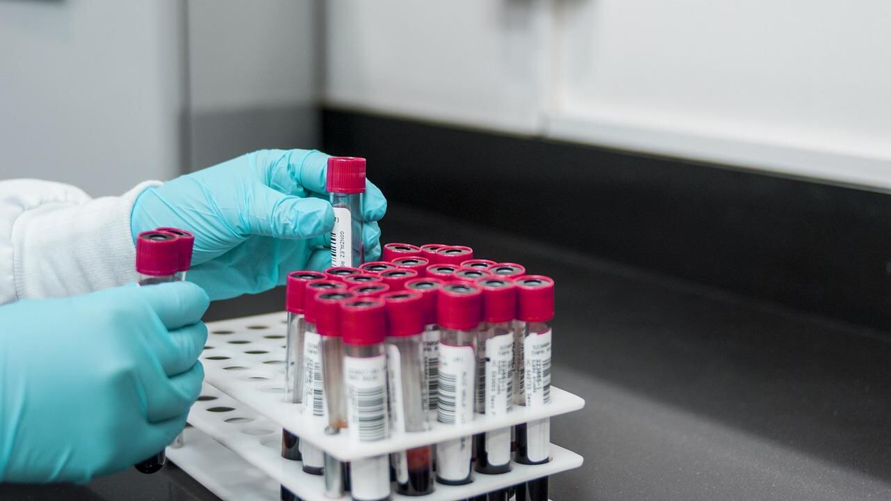 Muestras de laboratorio para descartar viruela del mono.