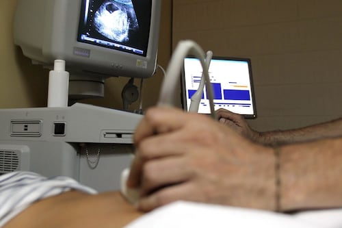 Cuestionan proyecto que “criminalizaría” el aborto en cualquier etapa de gestación