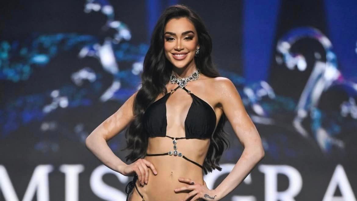 Joven con vitíligo se corona como Miss Grand República Checa 2024.