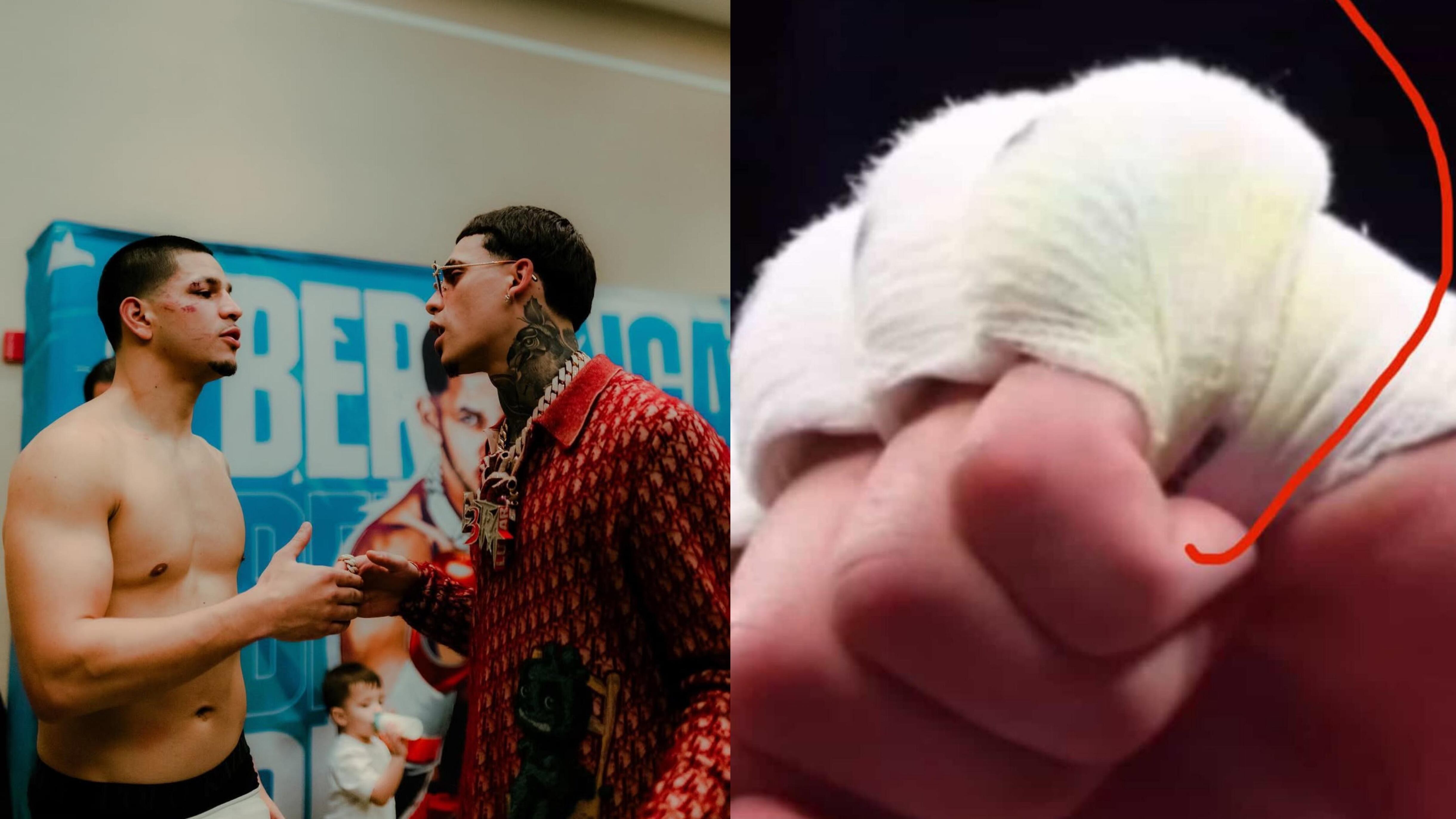 Luar La L asegura que Edgar Berlanga cayó por nocaut frente a Hamzah Sheeraz puesto que tenía "algo raro" en el vendaje de la mano izquierda.