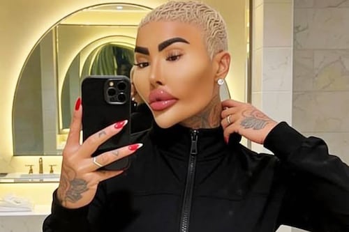 Muere reconocido influencer que quería verse como Kim Kardashian: Falleció tras operarse