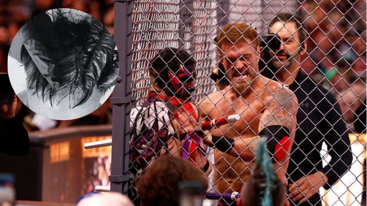 Finn Balor tendrá que tomarse un descanso I Getty Images