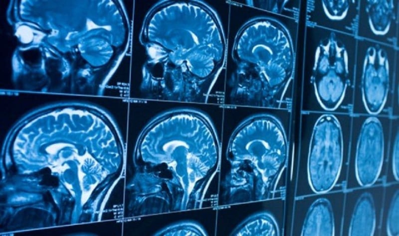 Imágenes de cerebro