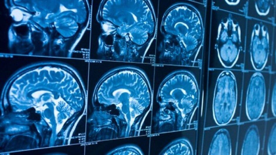 Imágenes de cerebro