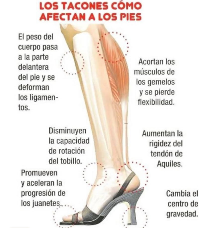Zapato de tacón y sus afectaciones