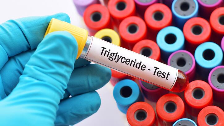 Los triglicéridos altos atentan contra la salud.